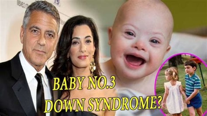Unveiling The Truth: George Clooney's Son And Down Syndrome